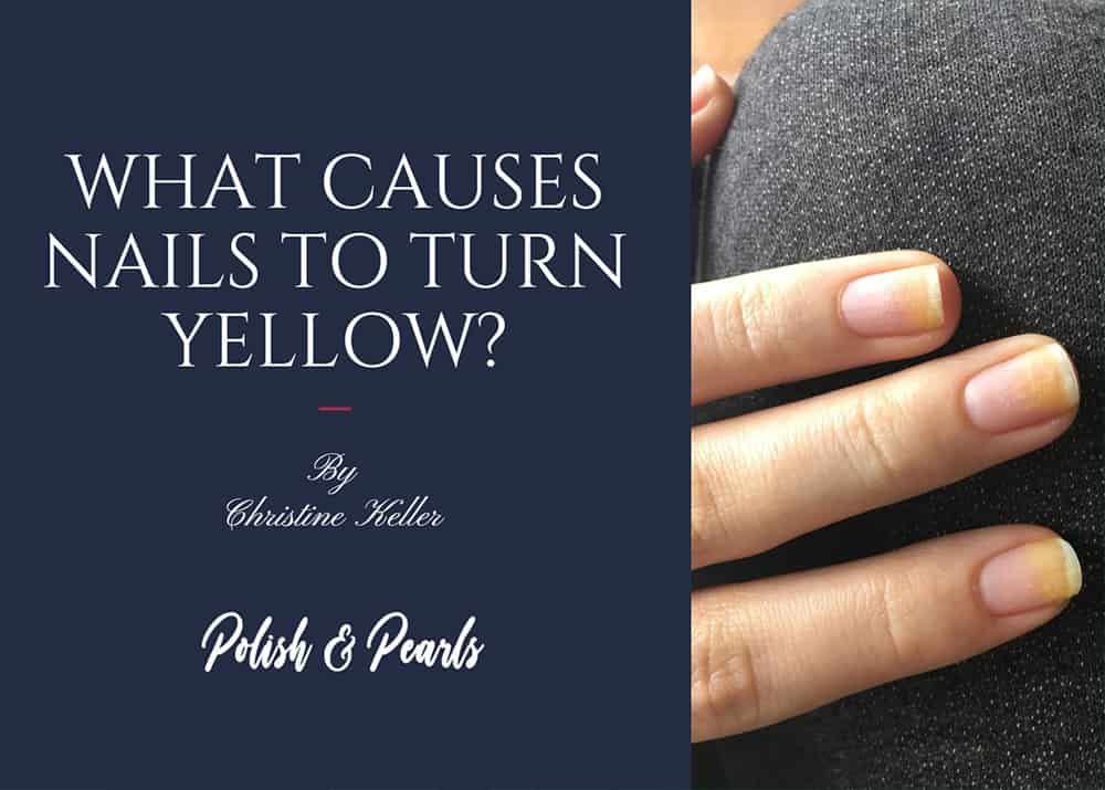 What Causes Nails to Turn Yellow? | Polish and Pearls