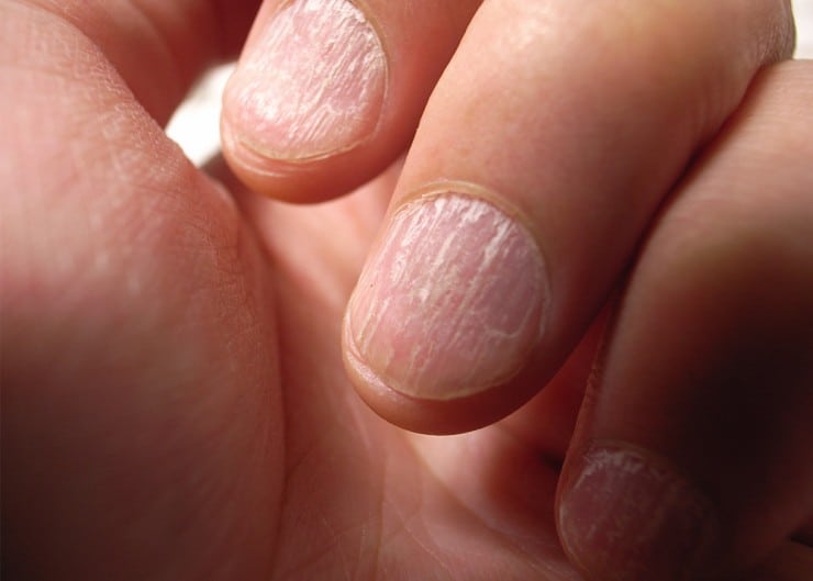How to Get Rid of Nail Ridges Polish and Pearls