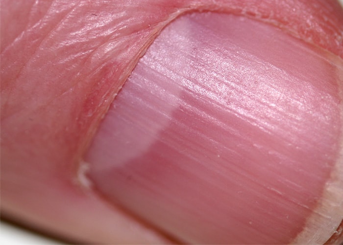 Why is There No Lunula on Fingernails? | Polish and Pearls