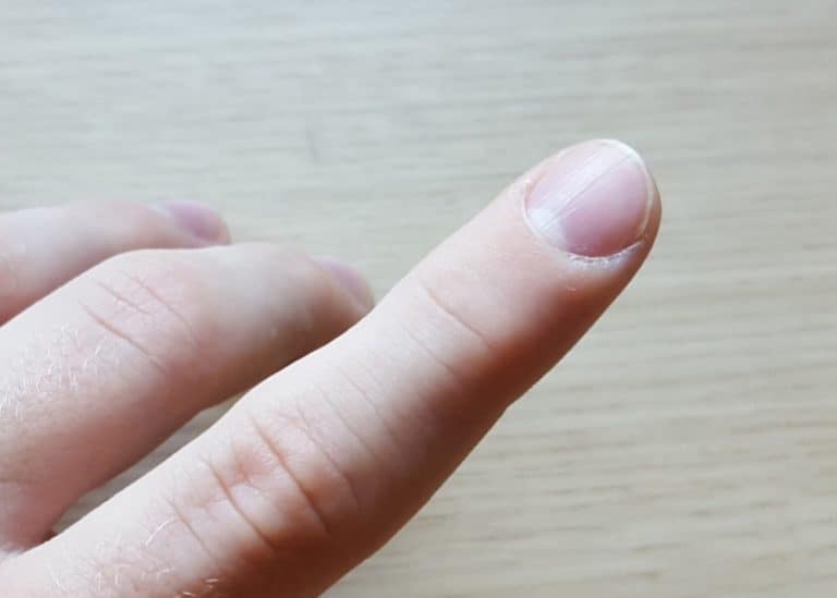 What is Lunula and What It Means for Your Health Polish and Pearls