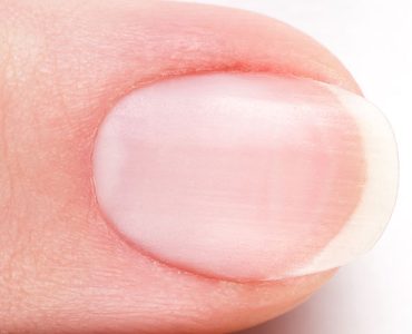 Why Do My Cuticles Itch?