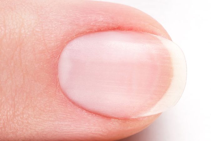Why Do My Cuticles Itch?