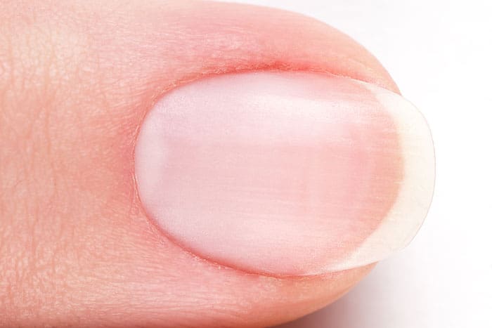 Why Do My Cuticles Itch? | Polish and Pearls