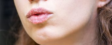 can you exfoliate lips everyday
