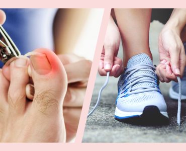 How Your Shoe Choices Can Trigger Ingrown Nails