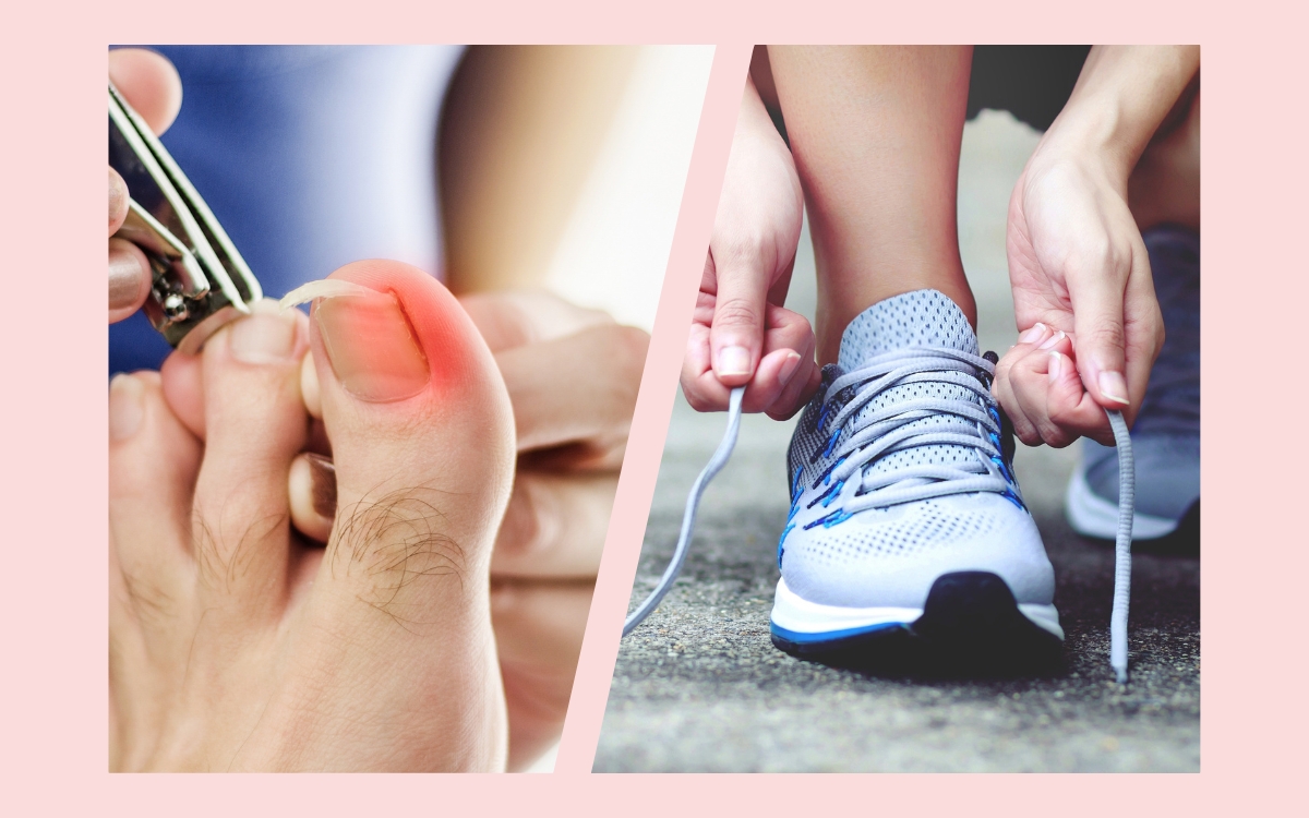 How Your Shoe Choices Can Trigger Ingrown Nails