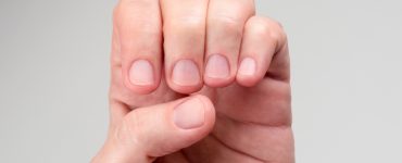 Effective Tips for Promoting Nail Growth and Preventing Brittleness